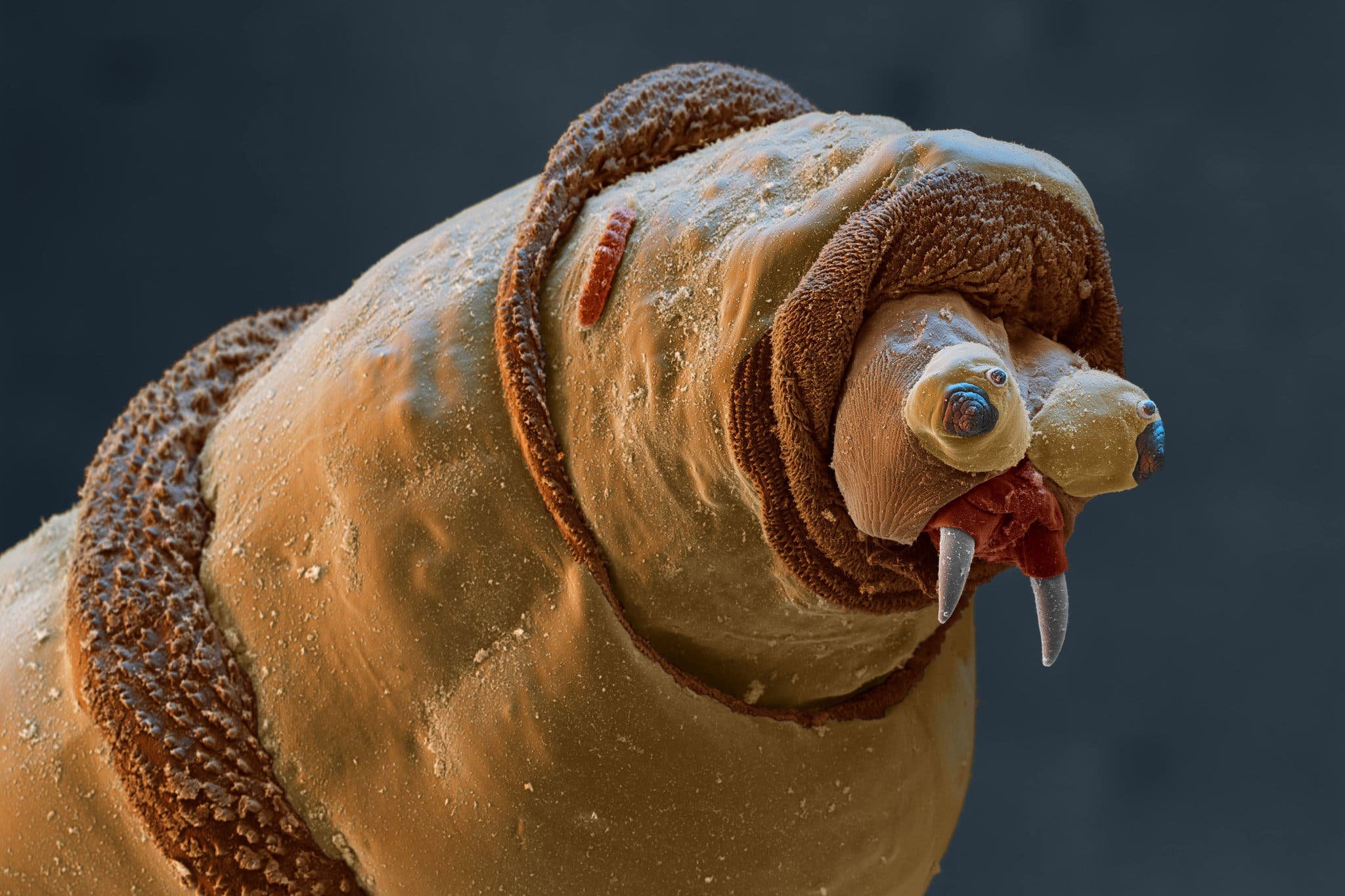 Бактерии на мухе. Дождевой червь под микроскопом. Микрофотография дождевого червя.