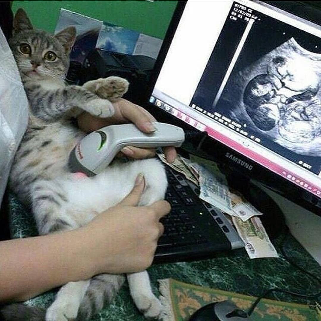 Смешные УЗИ