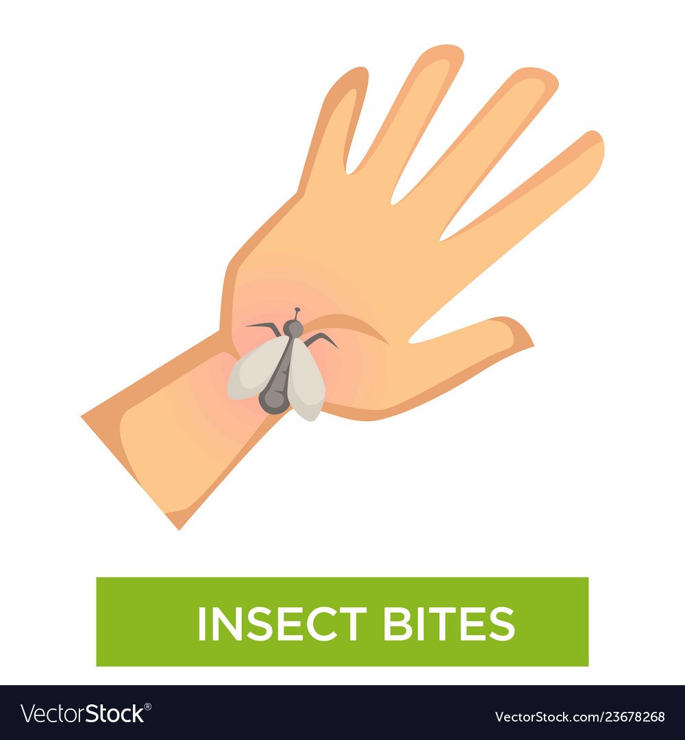 Опасность при укусе осы