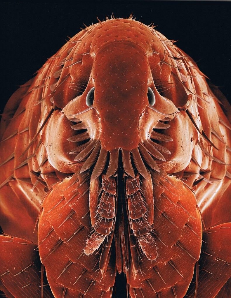 Под электронным микроскопом