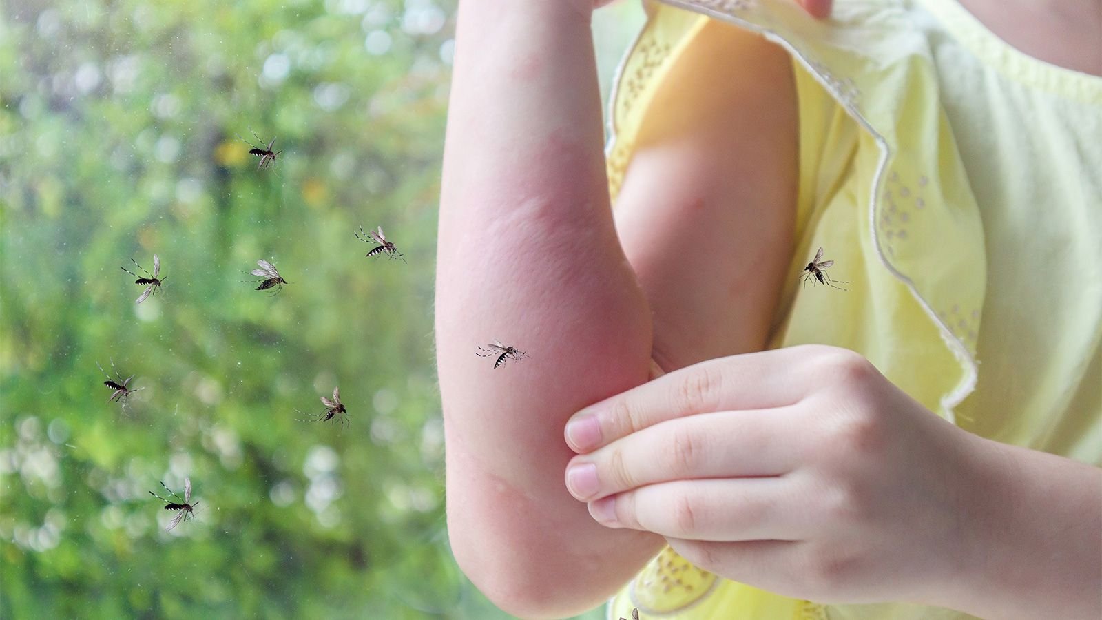 укусы насекомых ребенка фото