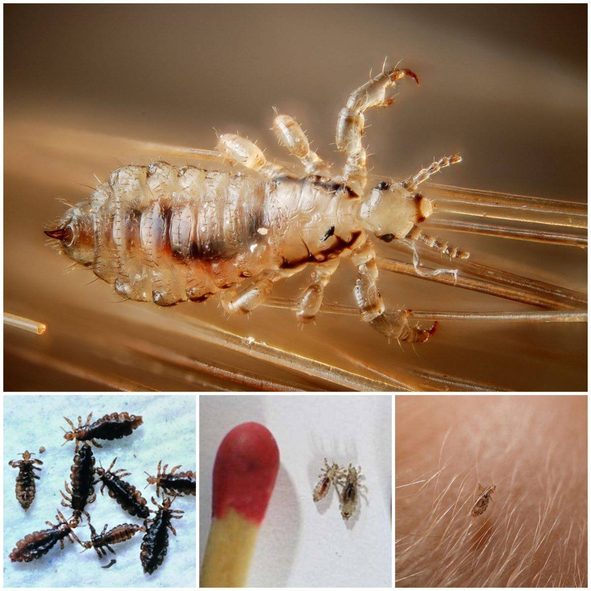 Вши любят горячую воду?