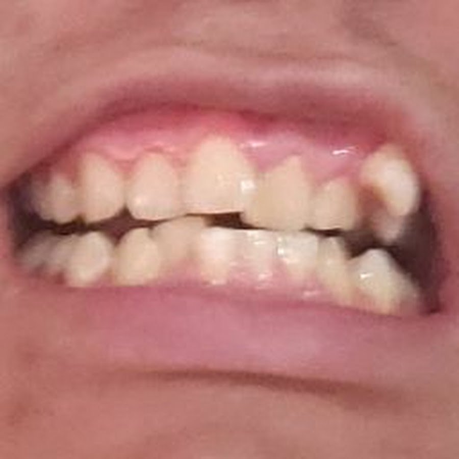 Боевой краб