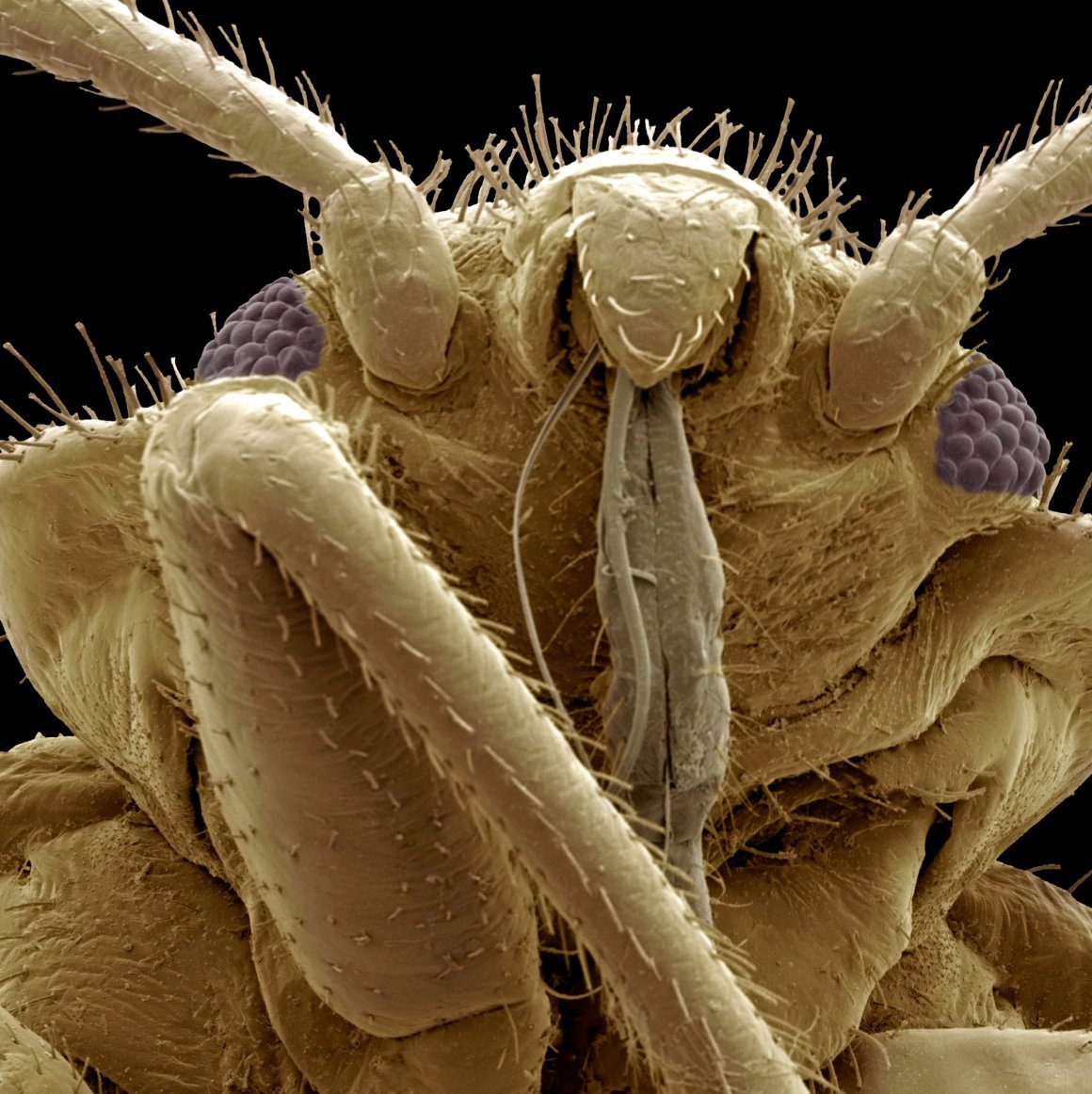 Постельный клоп под микроскопом