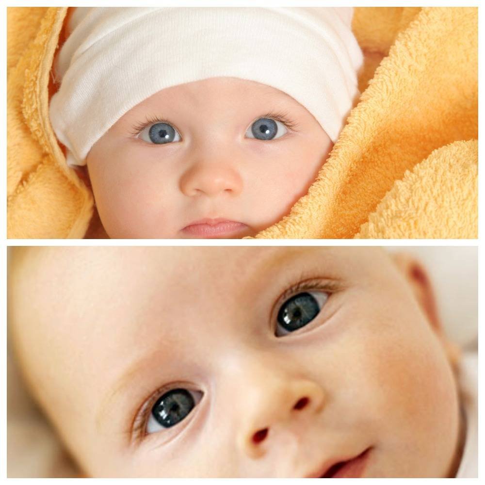 Белки глаз новорожденного. Желтоватые белки у но. Жёлтые белки глаз у новорожденных. Белки у новорожденного с желтым оттенком. У новорожденного белок глаза желтоватый.