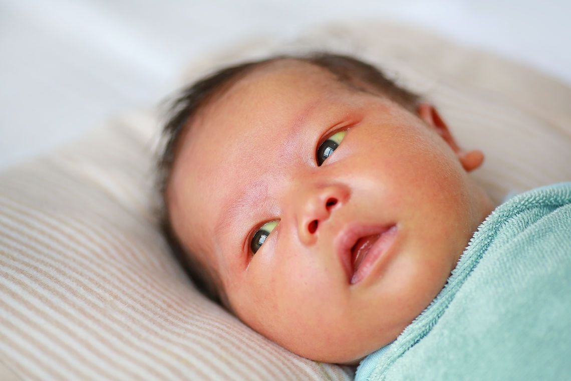 Желтушка у новорожденных склеры