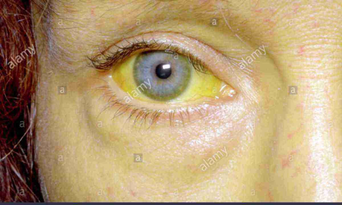 Желтый цвет глаз