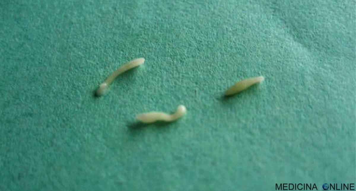 Микрофотография дождевого червя