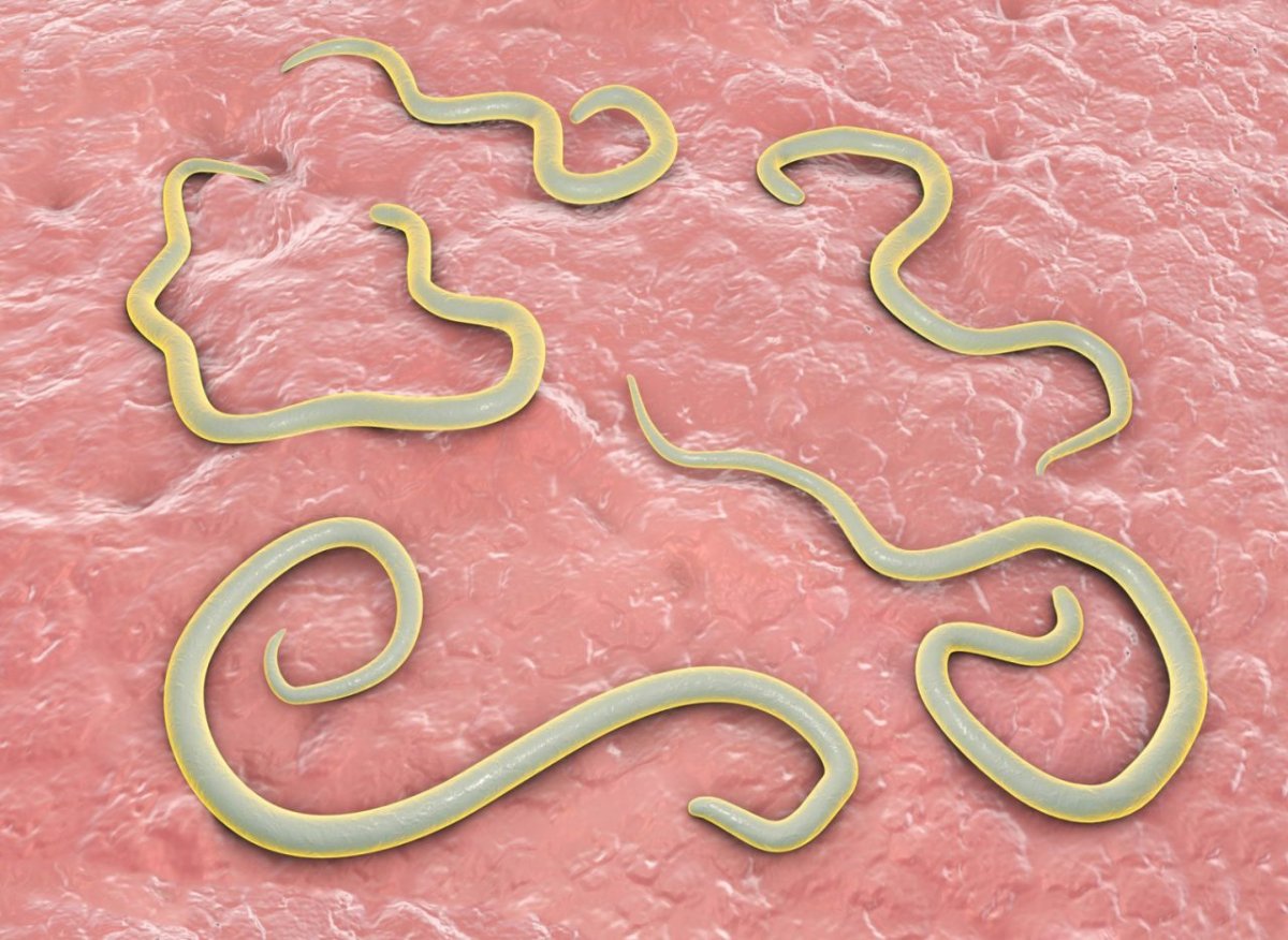 Паразитарные заболевания картинки