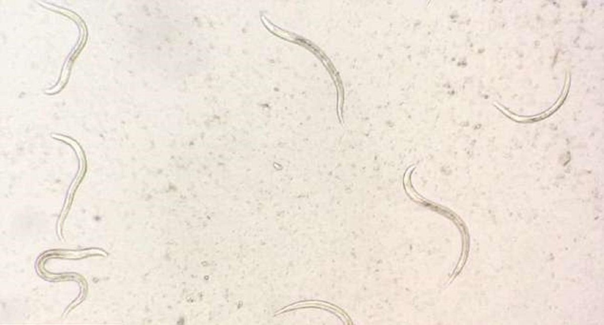 Стронгилоидоз - черви-паразиты под кожей.