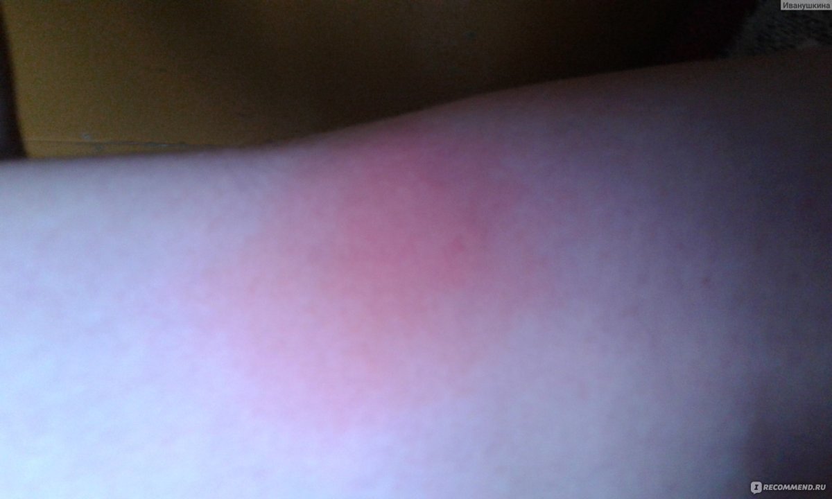 Комар Макросъемка