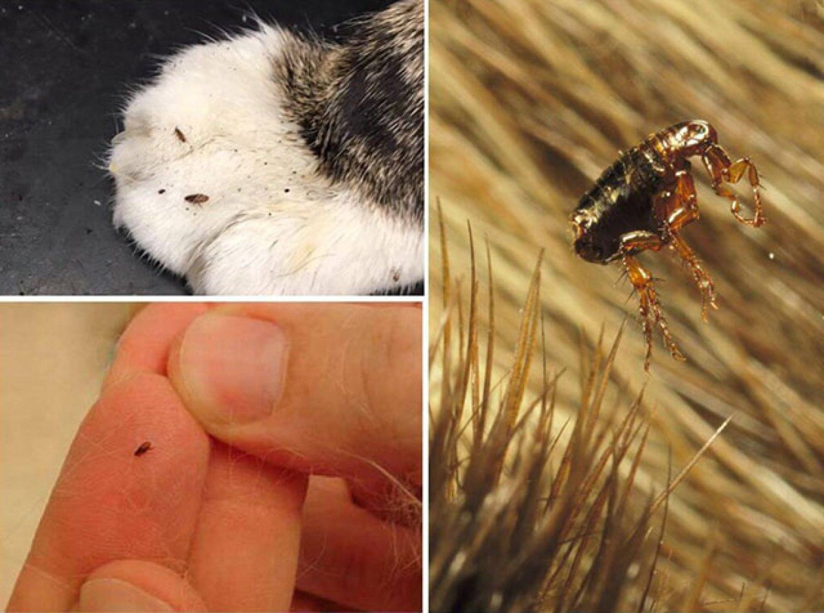 Вошь головная микроскоп