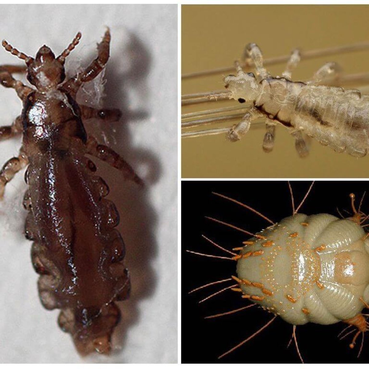 Платяная вошь педикулез