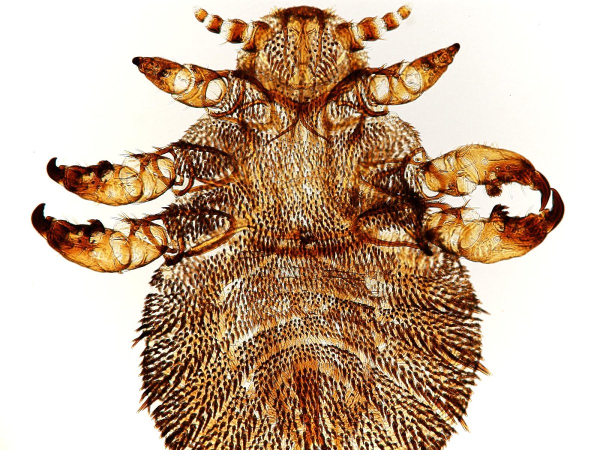 Векторная вошь