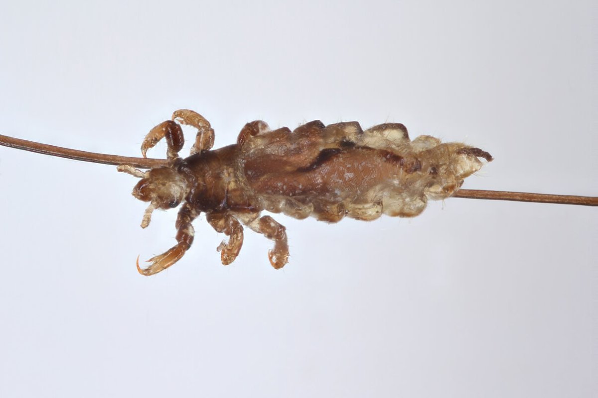 Вошь насекомое