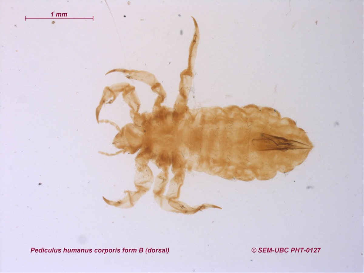 Мандавошки бельевые вши