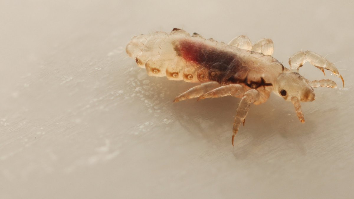 Как выглядит вошь на волосе