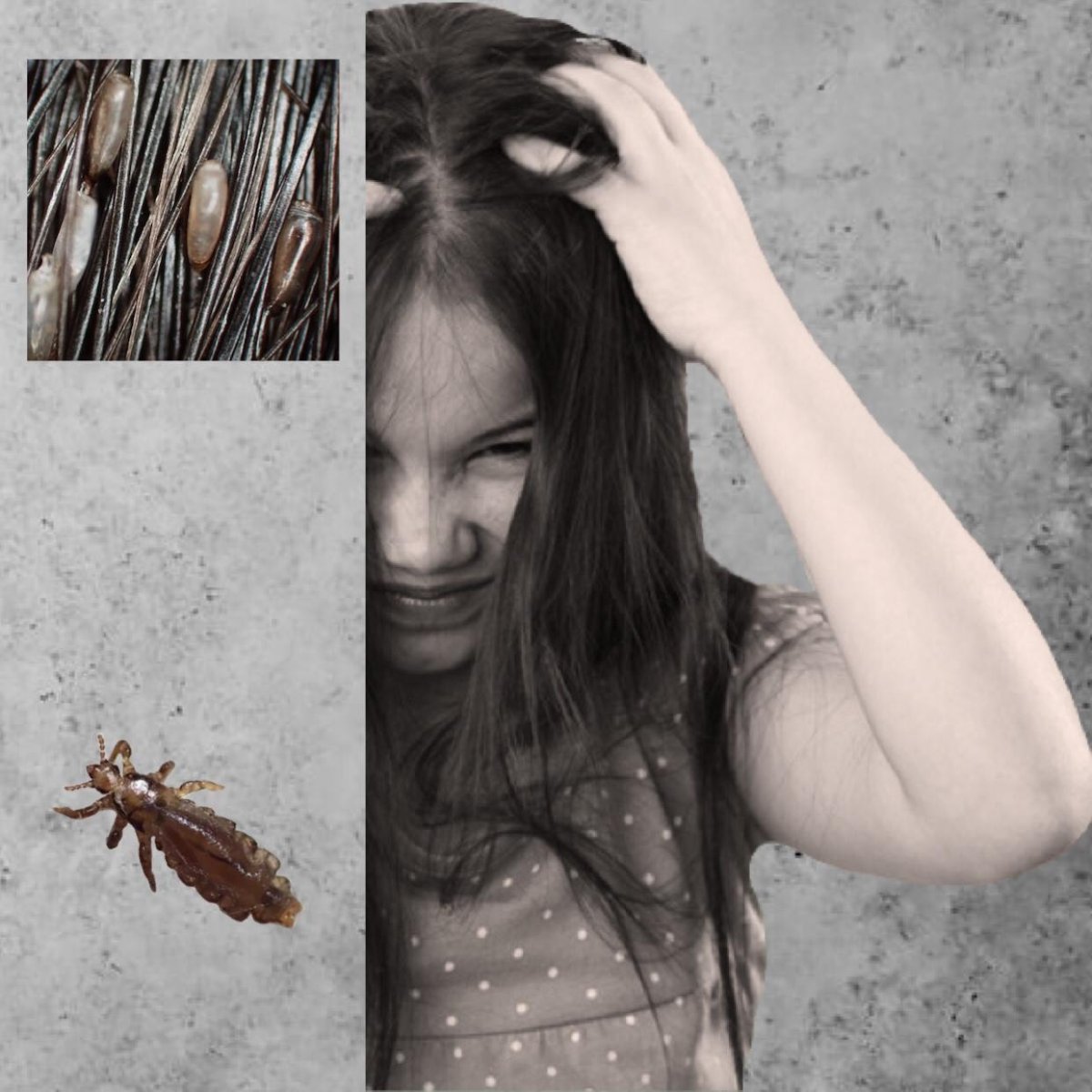 Вши схематично