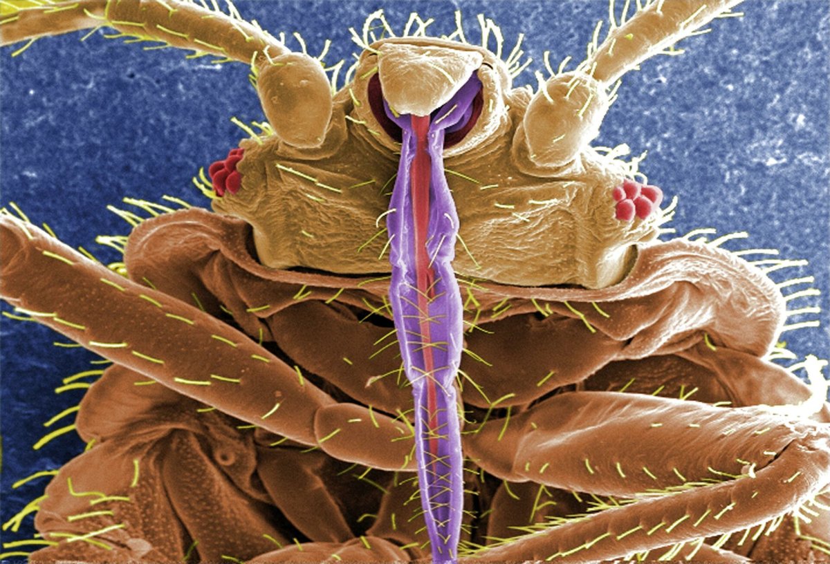 Пылевые клещи под микроскопом