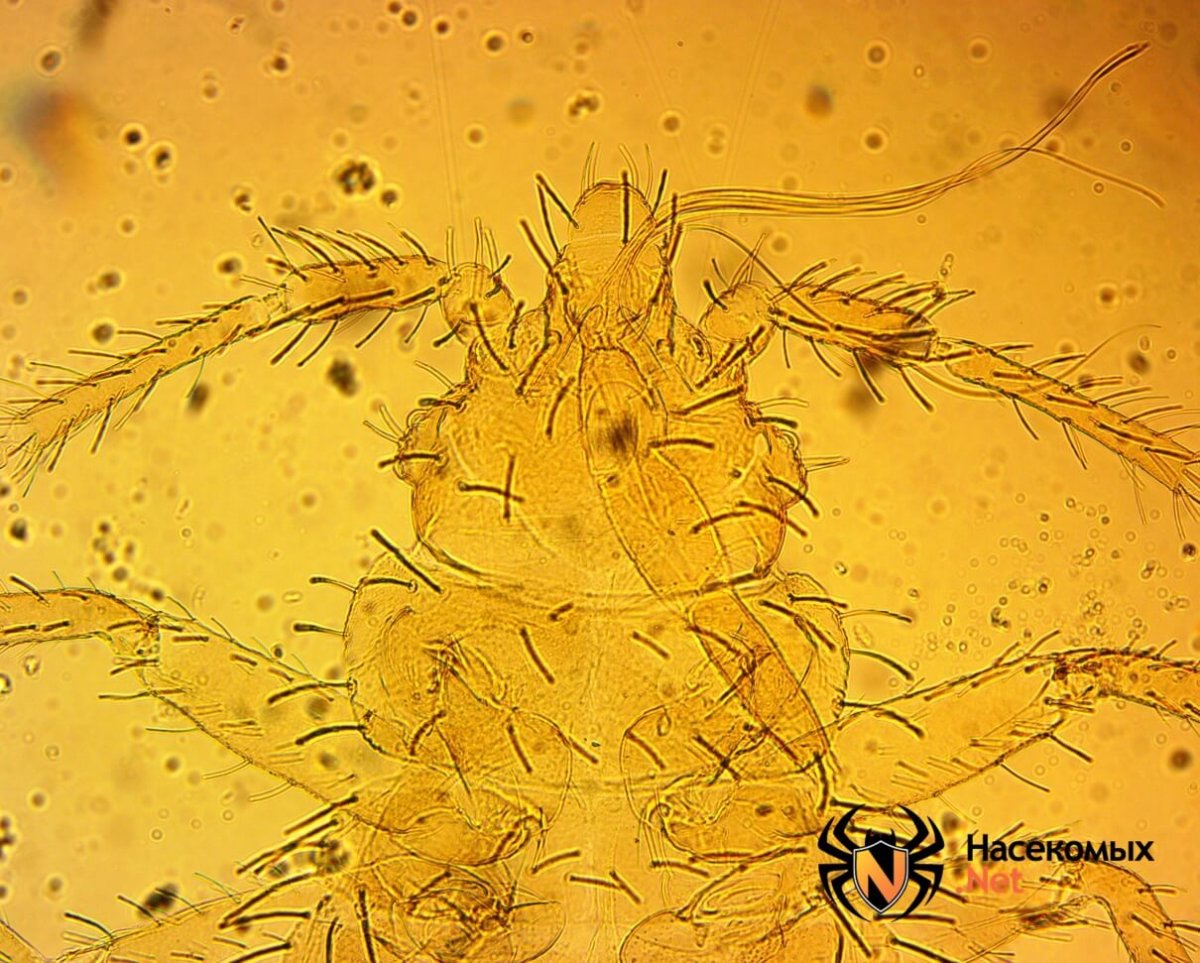 Имаго постельного клопа под микроскопом