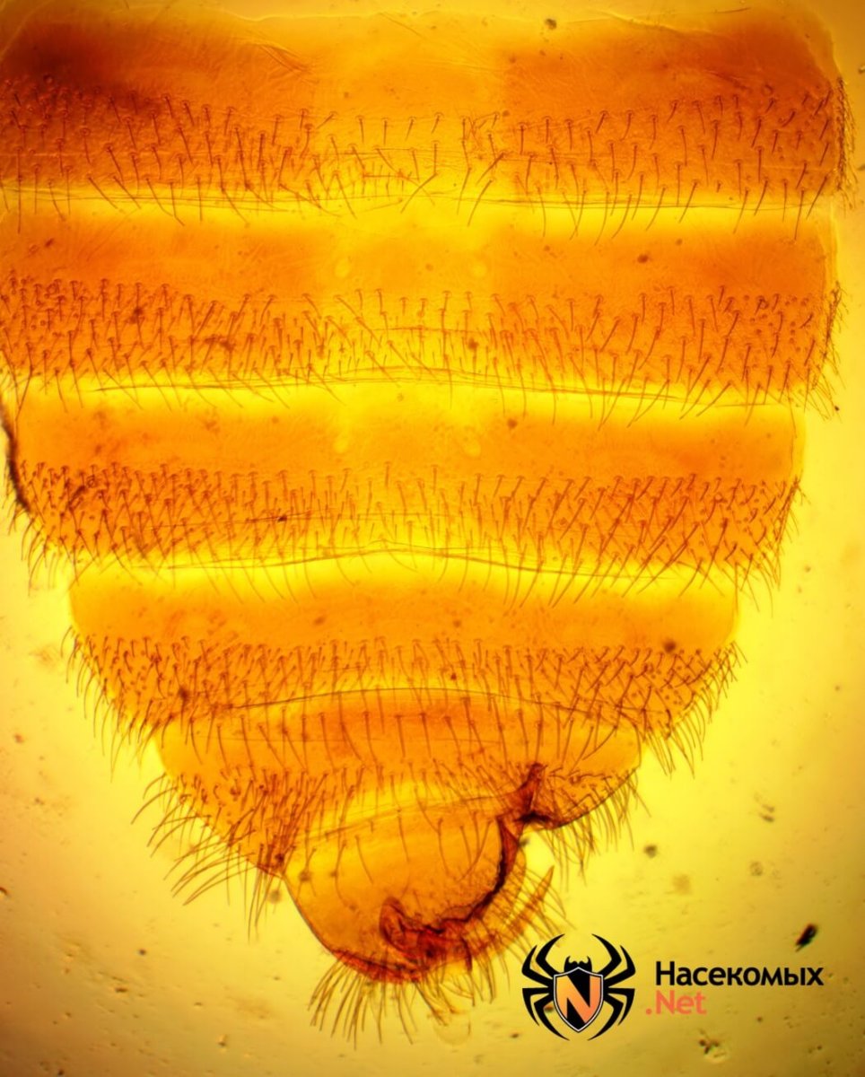 Мозг таракана под микроскопом