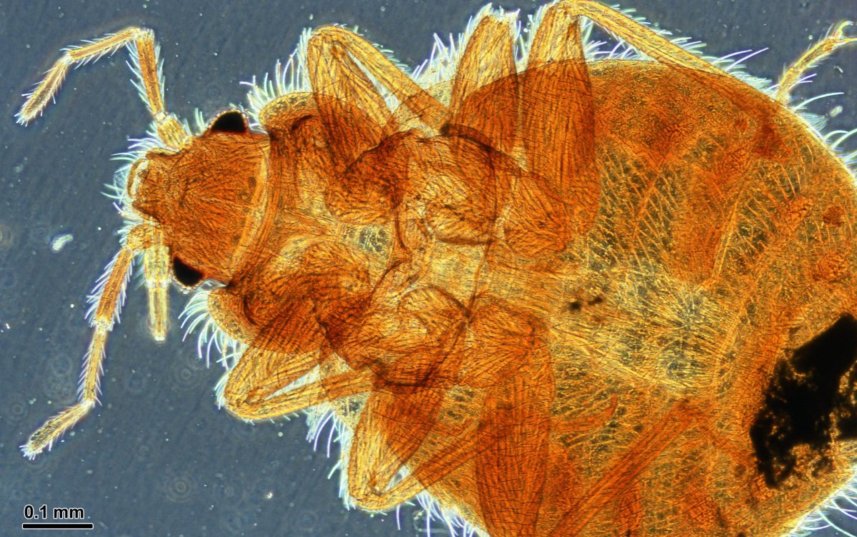 Постельный клоп препарат микроскоп