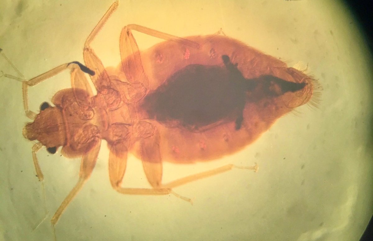 Имаго постельного клопа под микроскопом