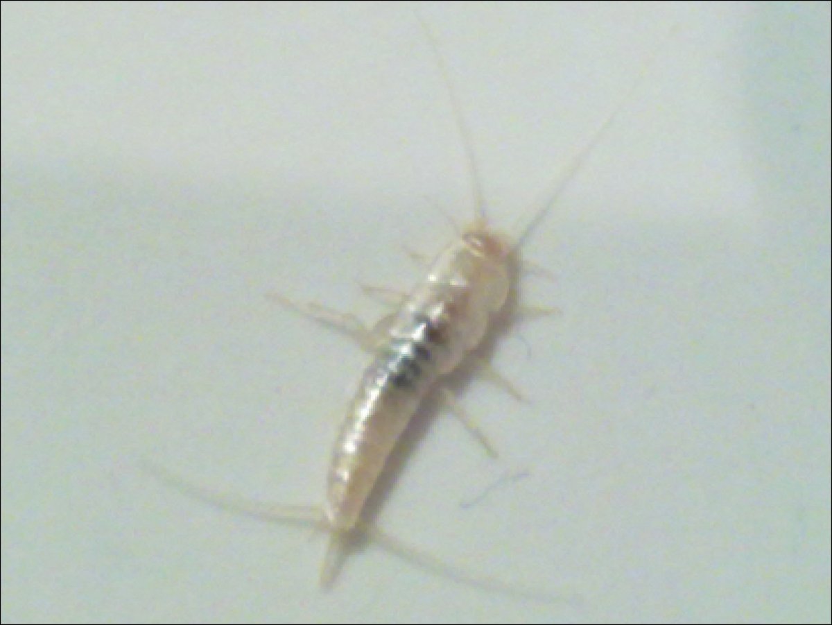 Личинка чешуйницы