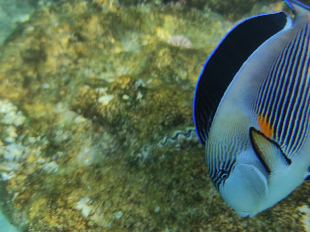 Хирург Королевский хепатус