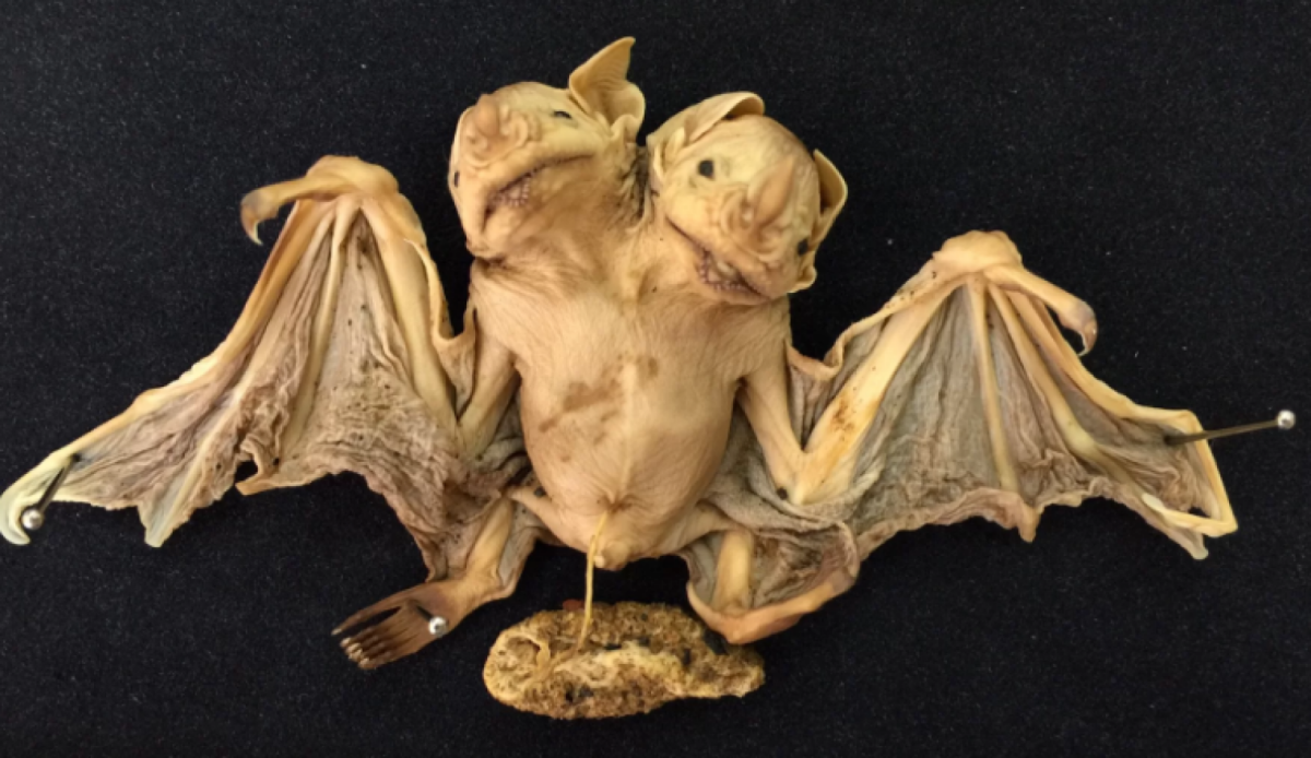 Сиамские Близнецы Кунсткамера