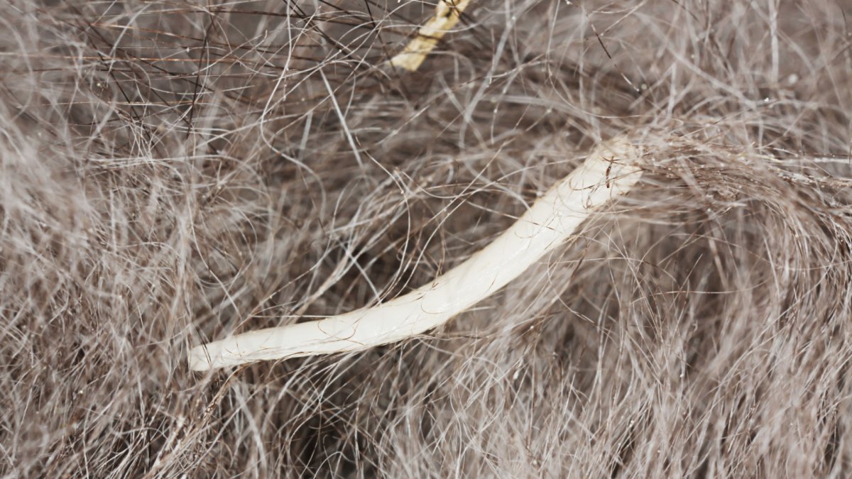 Ascaris lumbricoides заболевание