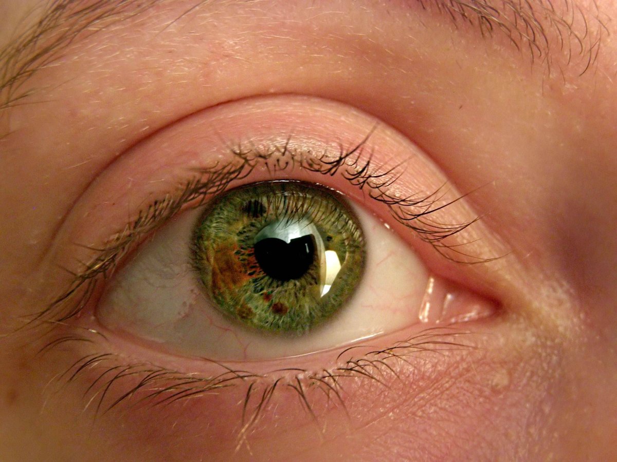 Выпадение слезной железы третьего века у кошки