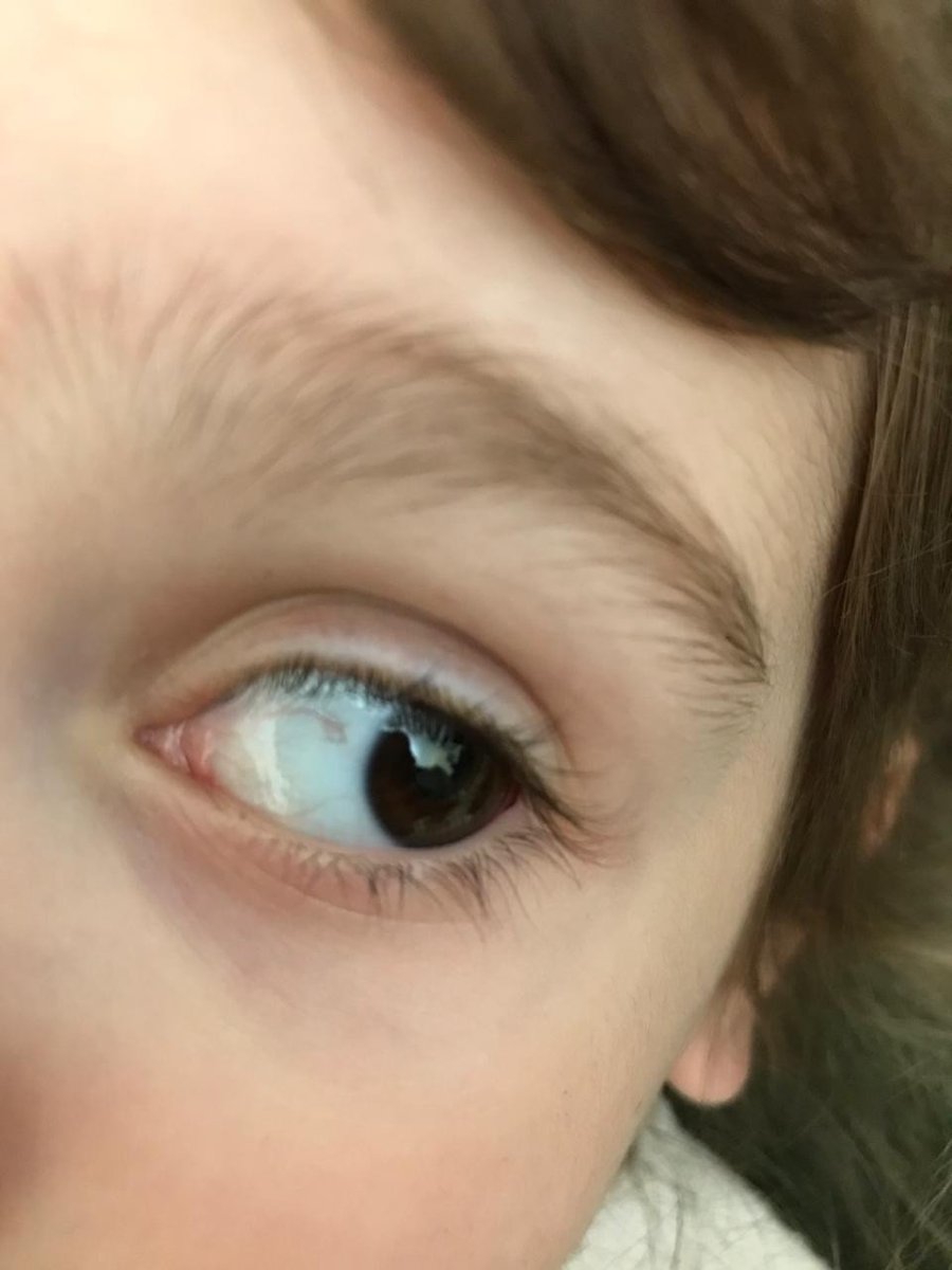 Кошачий конъюнктивит конъюнктивит кошачий