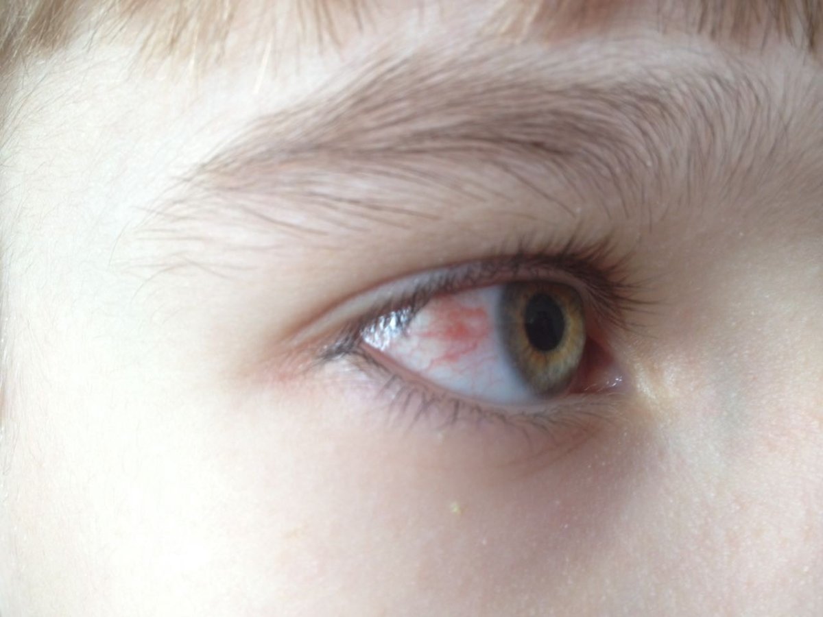 Странные глаза животных