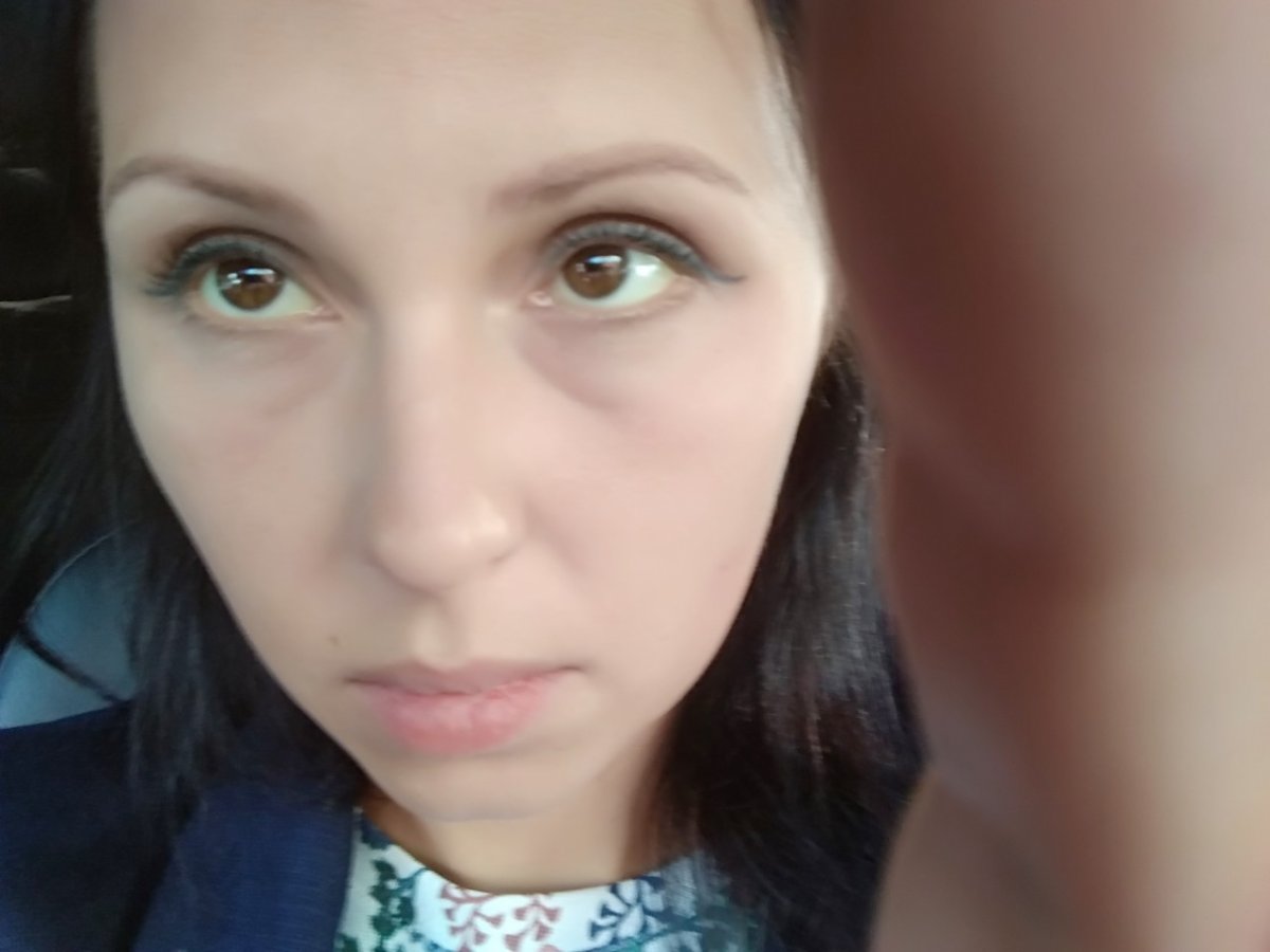 Конъюнктивит глаза у кота