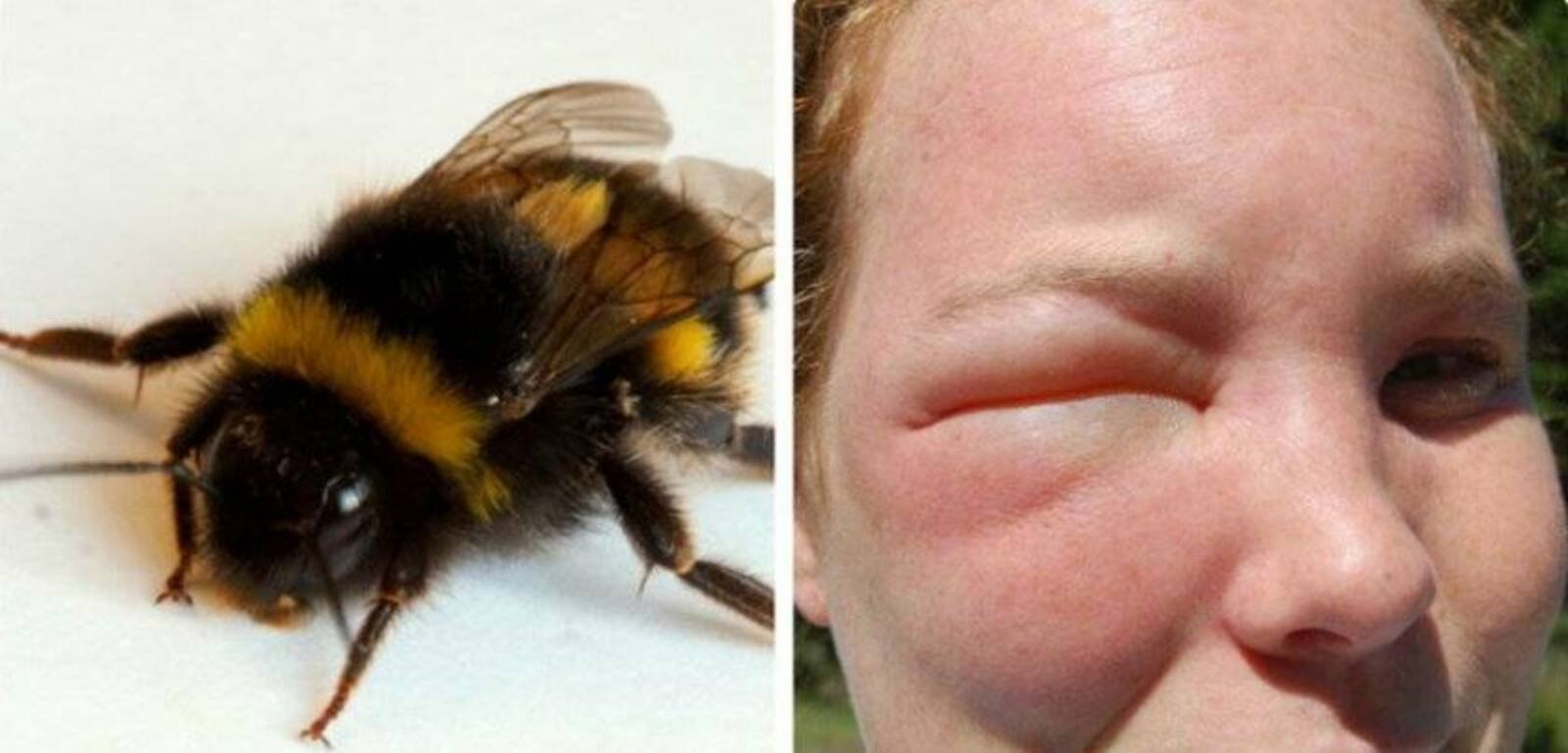 Пчела оставляет жало. Шмель пчела Оса Шершень укусы. Шершень слепень Овод Оса пчела Шмель. Шмель Оса Шершень. Оса слепень Овод пчела.
