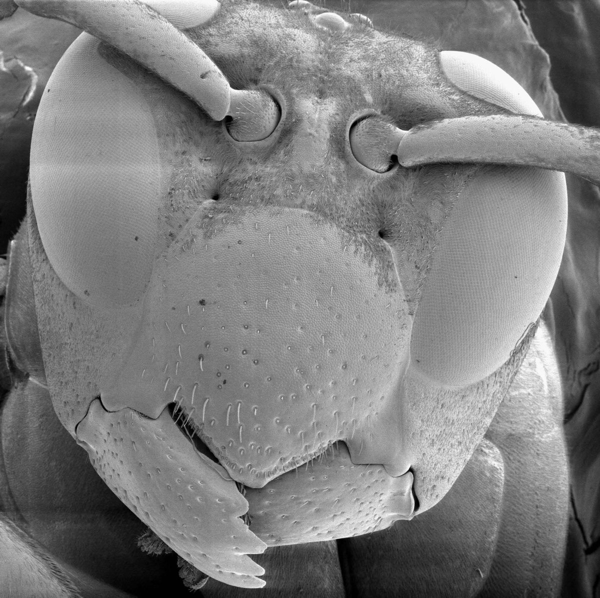 Микробы под ногтями под микроскопом