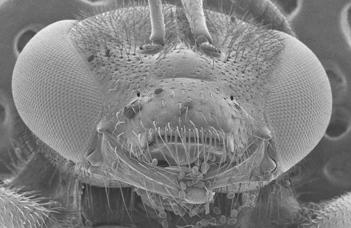 Электронный микроскоп снимки