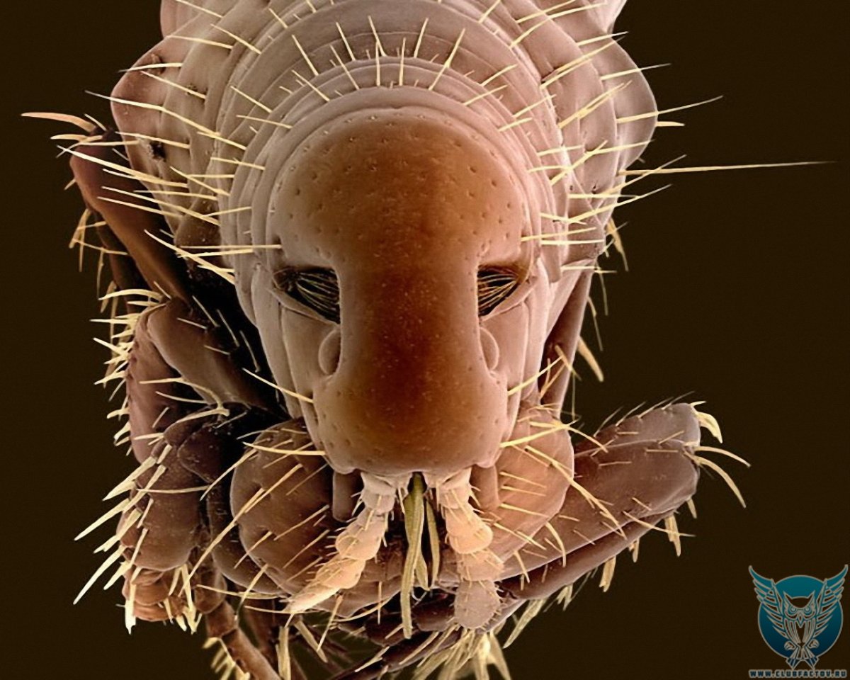 Вши головные под микроскопом