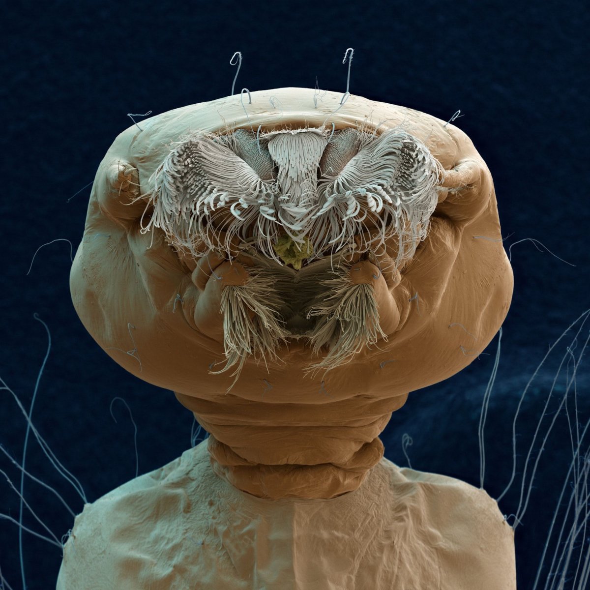 Микробы под микроскскопом