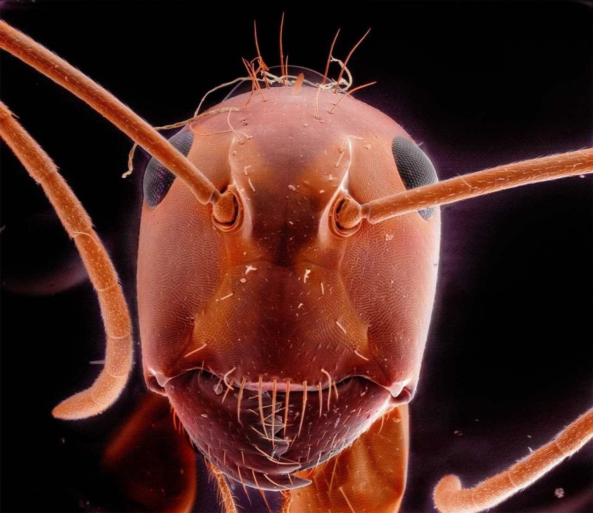 Дождевые черви под микроскопом