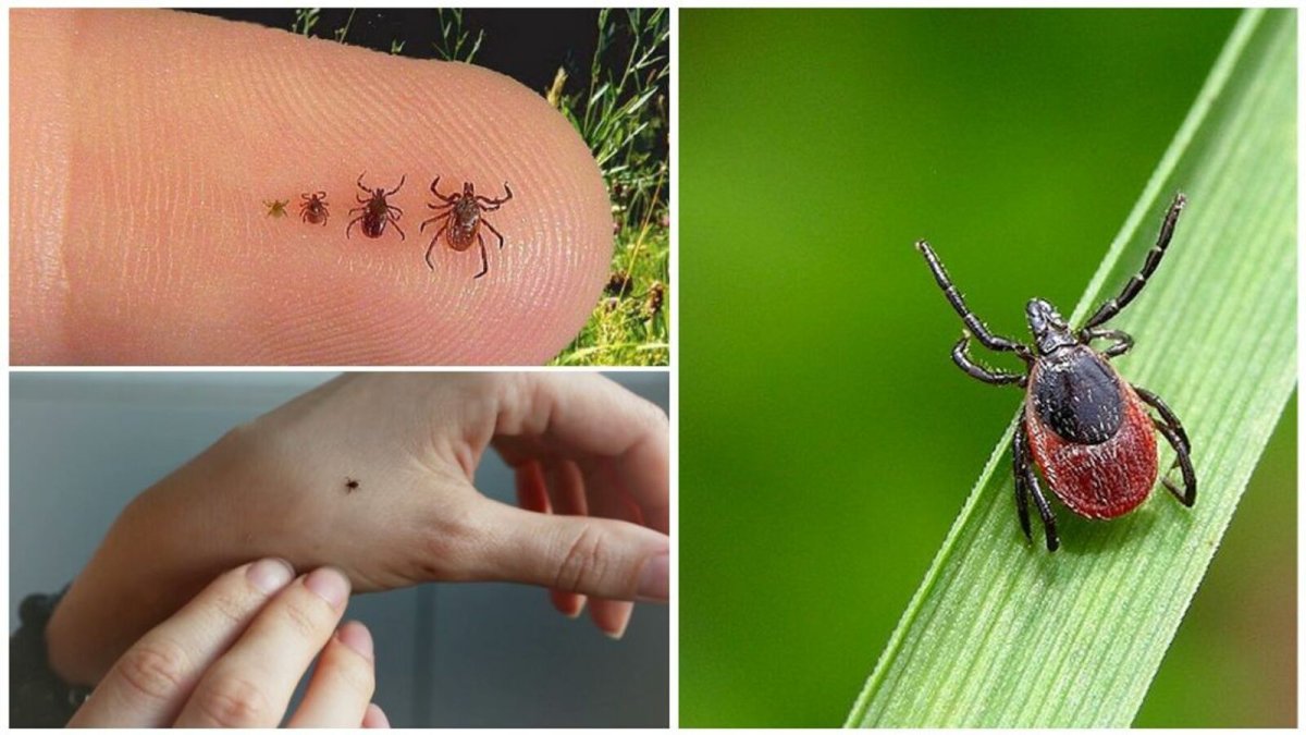 Энцефалитный клещ Энцефалитный клещ