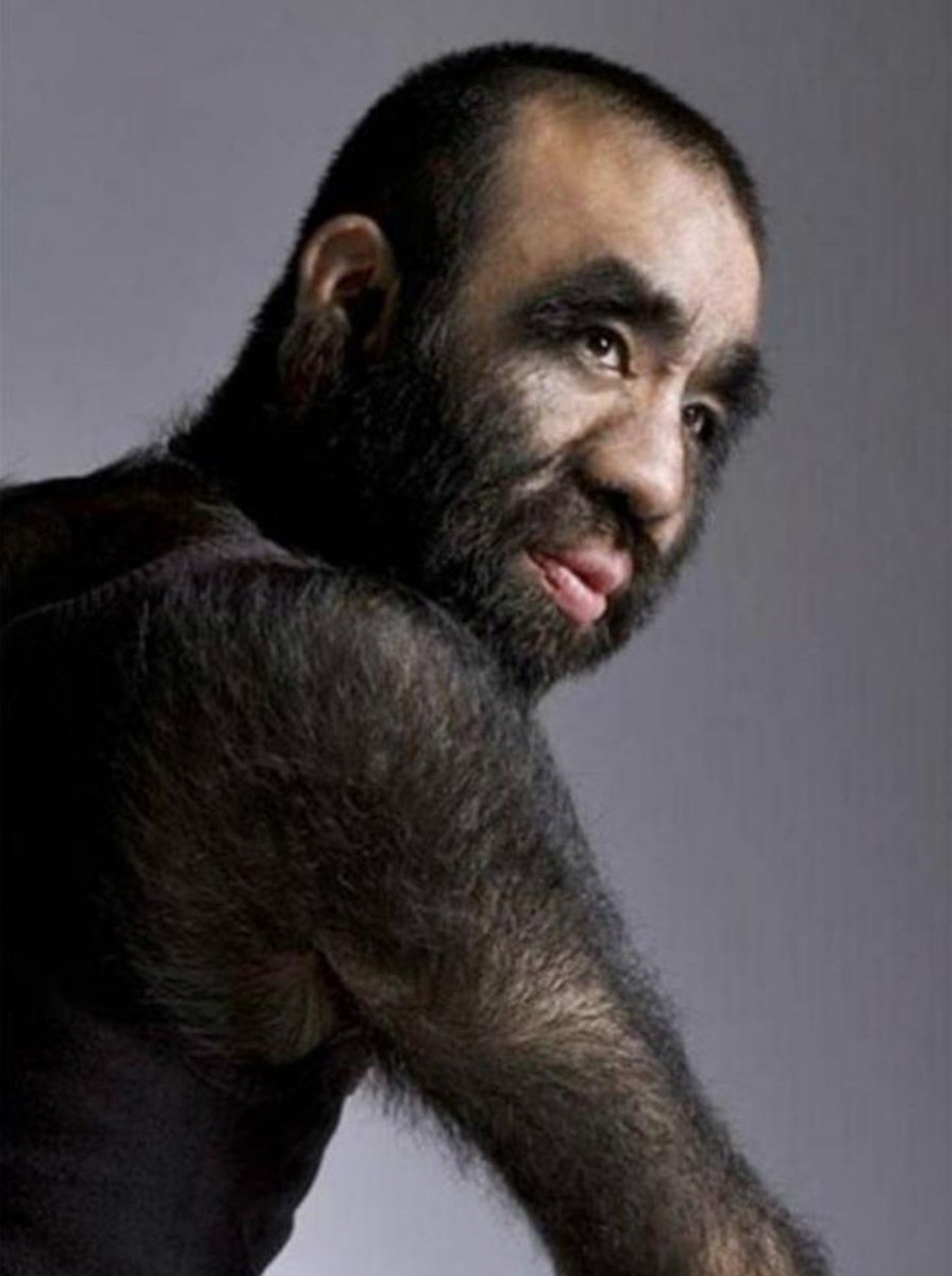 Волосволосатый человек