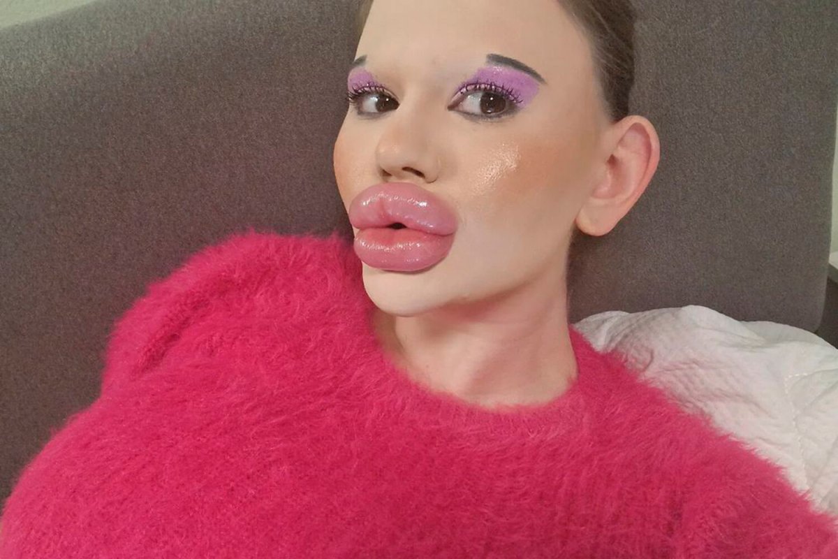 Самые большие губы в мире Андреа Иванова