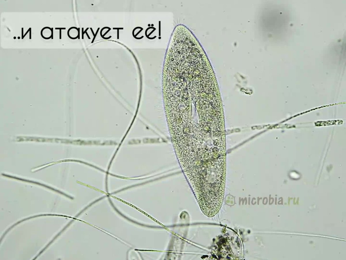 Инфузория туфелька под микроскопом