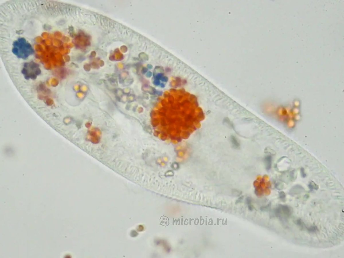 Инфузория туфелька